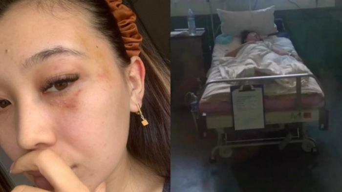Кызылординка осталась инвалидом после ссоры с мужем
                21 ноября 2023, 07:34