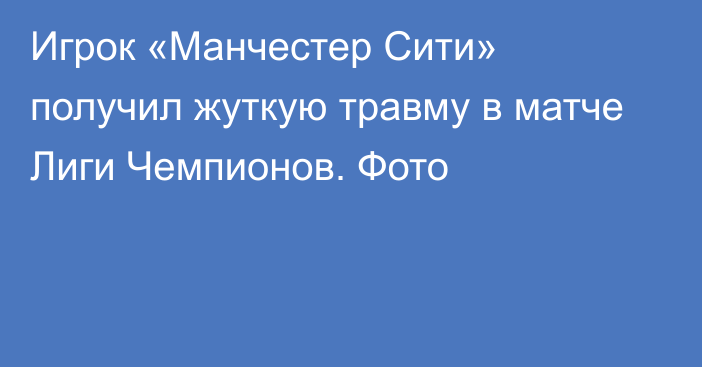 Игрок «Манчестер Сити» получил жуткую травму в матче Лиги Чемпионов. Фото